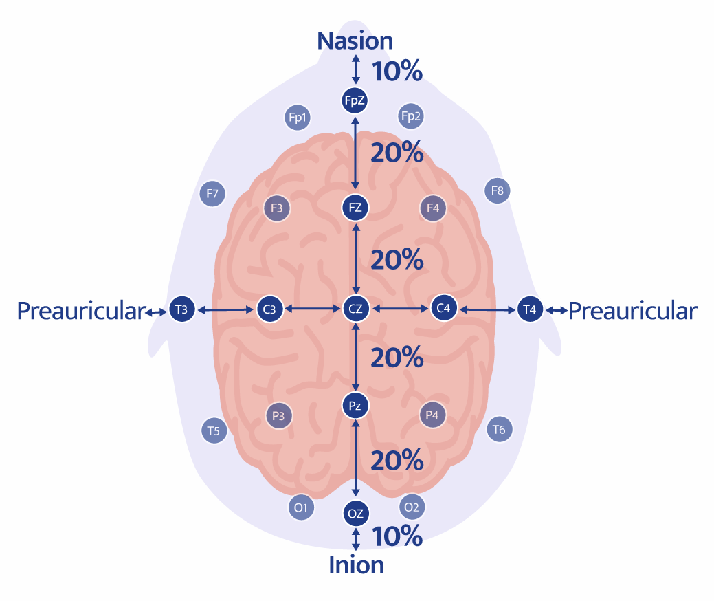 Overhead 10/20 electrode map showing nasion, inion, preauricular points, electrode labels, and 10 percent and 20 percent spacing.